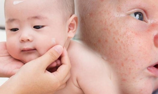 Đối với trẻ sơ sinh, làn da của chúng rất mỏng manh và cần được chăm sóc đặc biệt. Là cha mẹ, điều cần thiết là thiết lập thói quen chăm sóc da để giữ cho làn da của bé khỏe mạnh và không bị kích ứng. Đồ họa: Thiện Nhân