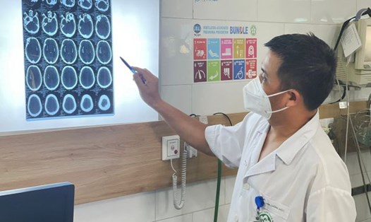 TS.BS Nguyễn Trung Nguyên - Giám đốc Trung tâm Chống độc, Bệnh viện Bạch Mai - kiểm tra phim chụp cho bệnh nhân ngộ độc rượu. Ảnh: Bệnh viện cung cấp