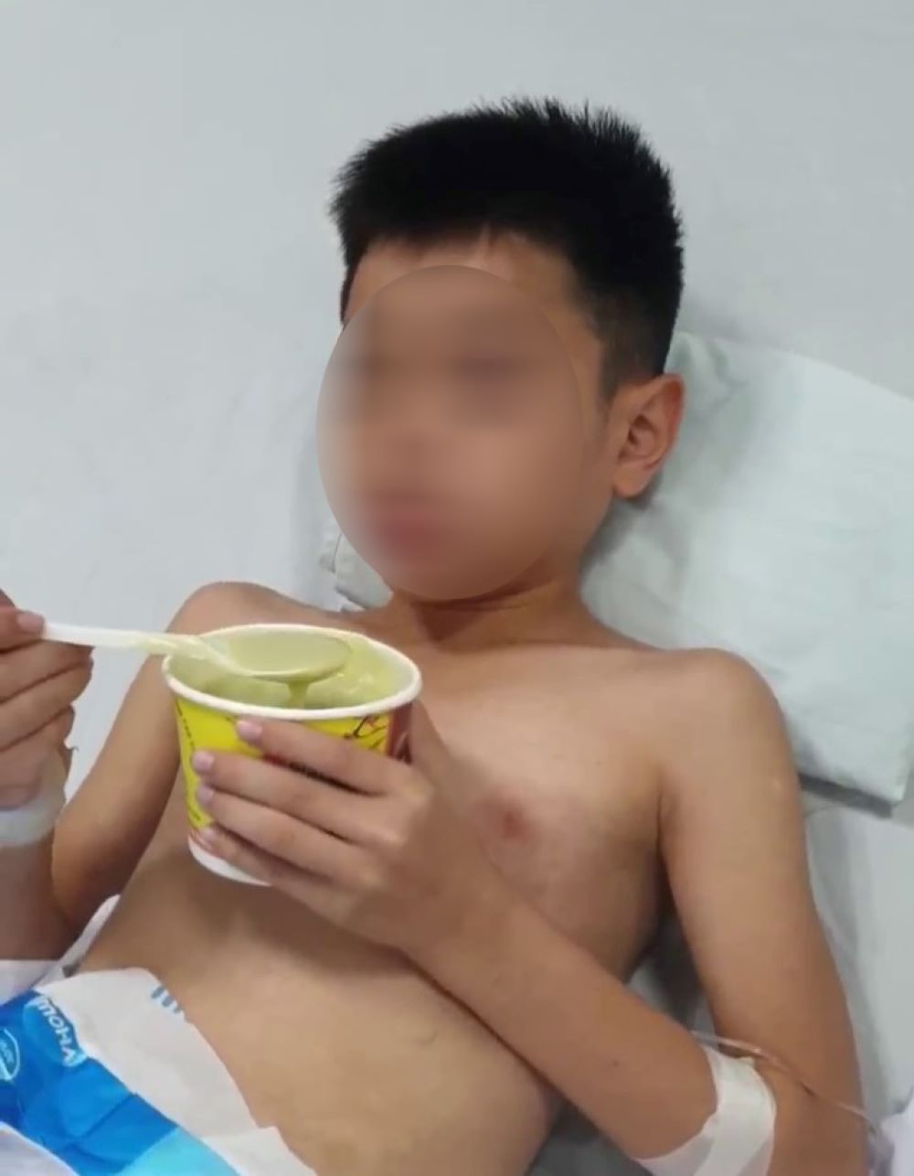 Cháu bé 10 tuổi đã hồi phục và có thể tự xúc cháo ăn. Ảnh: Bệnh viện cung cấp