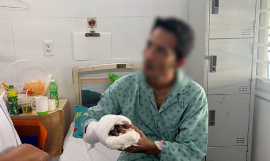Bệnh nhân sau phẫu thuật tai nạn máy nghiền cà phê. Ảnh: Nguyễn Ly