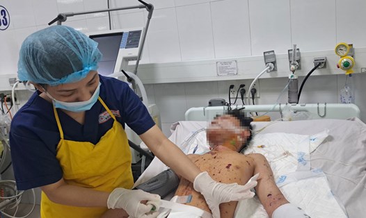 Bệnh nhân đang được điều trị tại khoa Gây mê hồi sức, Bệnh viện Đà Nẵng. Ảnh: Bệnh viện Đà Nẵng