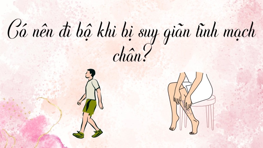 Should people with varicose veins walk? Photo: Phuong Anh