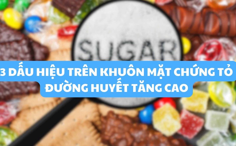 3 signs on the face that show high blood sugar