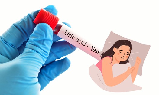 Uống nước trước khi đi ngủ sẽ giúp cơ thể bài tiết axit uric. Ảnh ghép: HƯƠNG SƠN