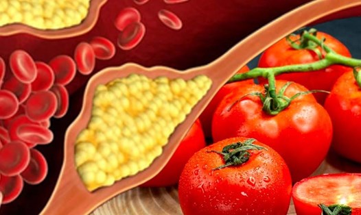 Cà chua có thể giúp giảm mức cholesterol và cải thiện sức khỏe tim mạch. Đồ hoạ: Thiện Nhân