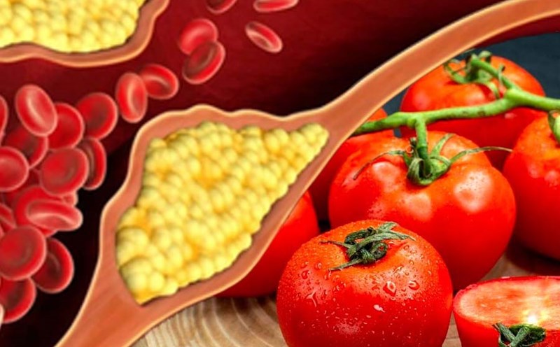 Tomatoes can help lower cholesterol levels and improve heart health. Graphics: Thien Nhan