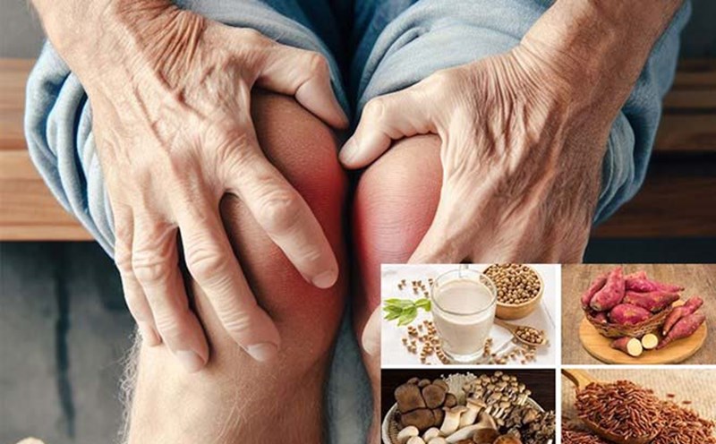An orthopedic doctor has explained that an alkaline diet can help reduce pain caused by arthritis. Graphics: Ngoc Thuy