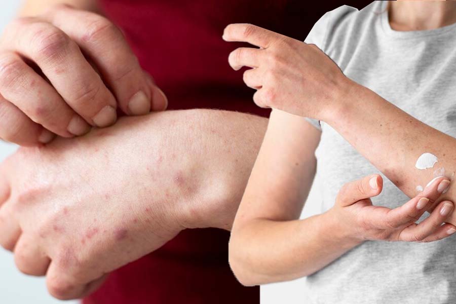 Common causes of skin rashes. Graphics: Thien Nhan