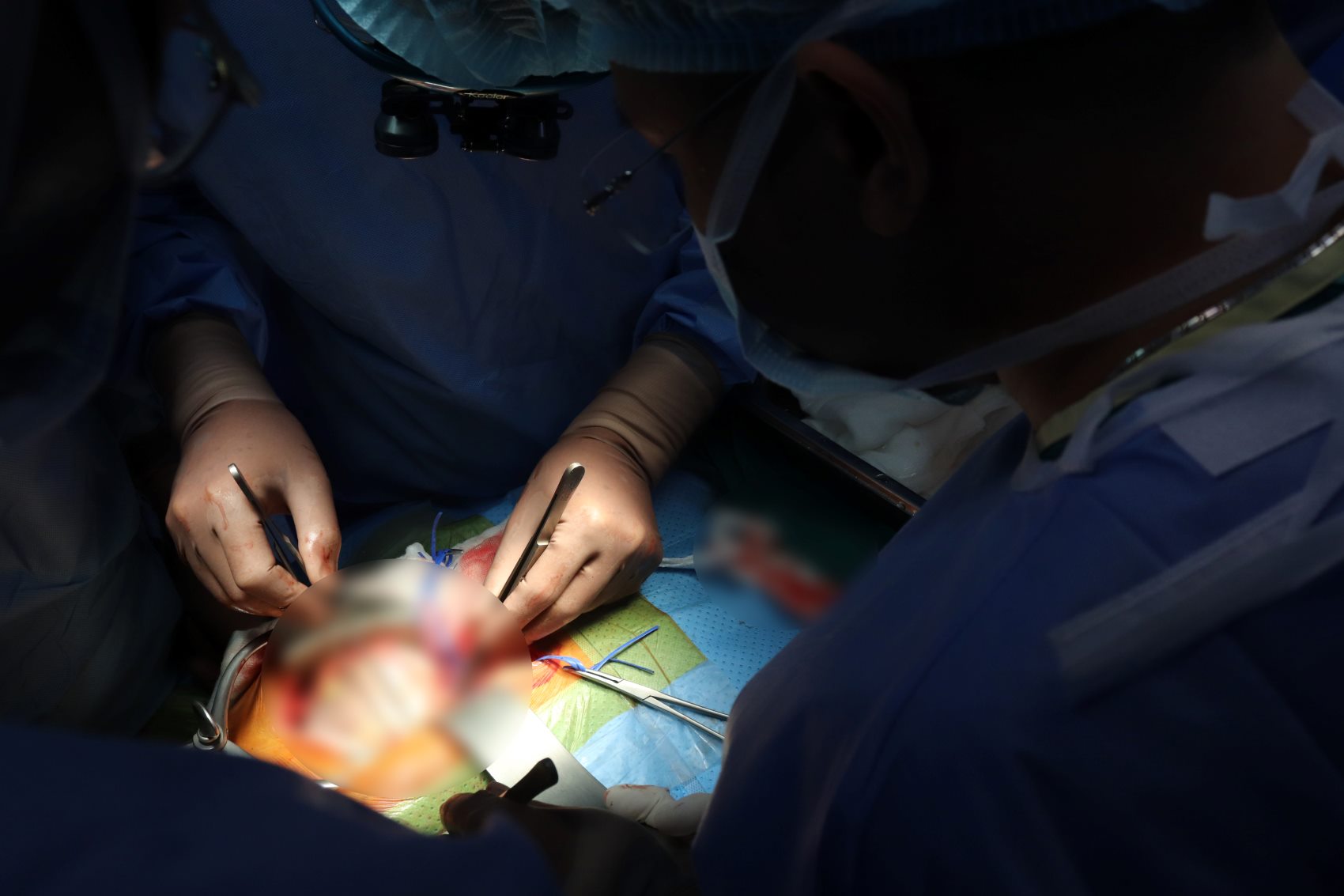 Children's Hospital 2 speeds up liver transplants to save more children. Photo: Thanh Chan
