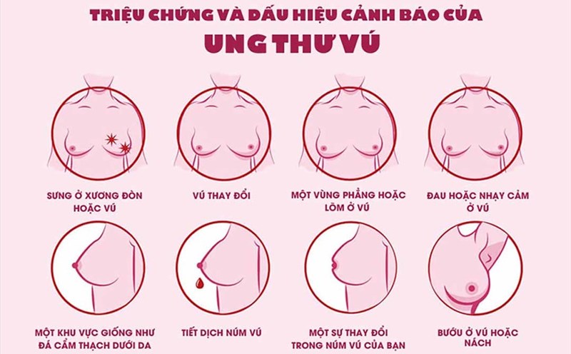Symptoms of breast cancer. Photo source: K Hospital