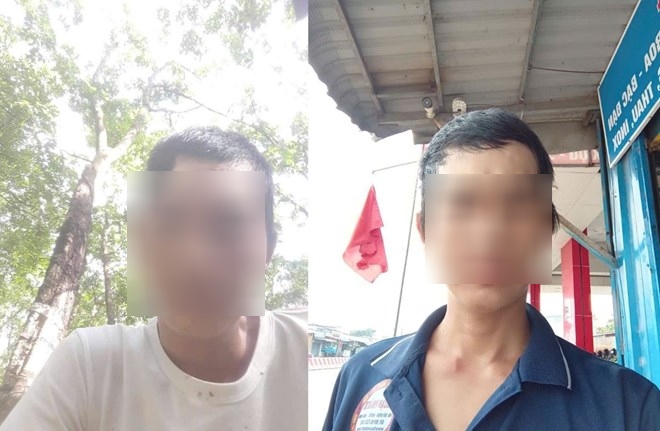 Image of Mr. L.V.T before and after skull patch surgery. Photo: Provided by the character