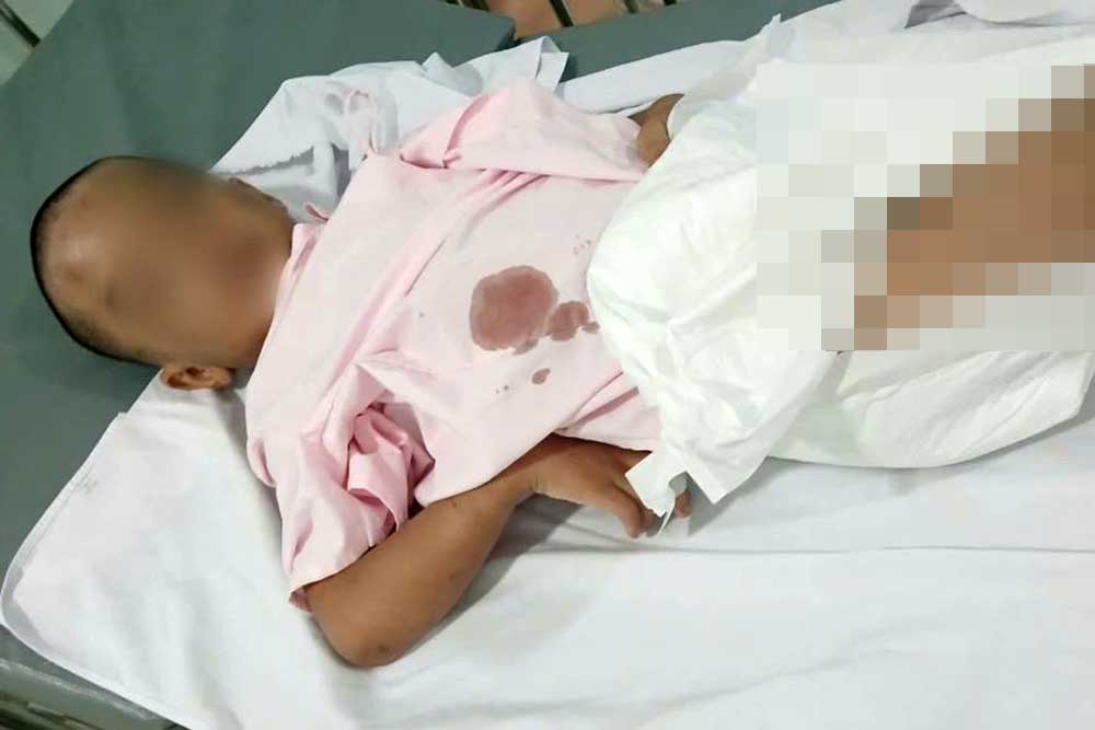 Baby T.K. suspected of being abused by his biological father is being treated at Children's Hospital 1. Photo: Minh Anh