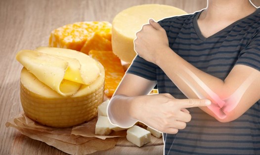 Phô mai chứa nhiều canxi, protein, vitamin... tốt cho xương. Đồ họa: Thanh Thanh