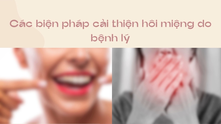 Measures to improve bad breath caused by illness. Graphics: Phuong Anh