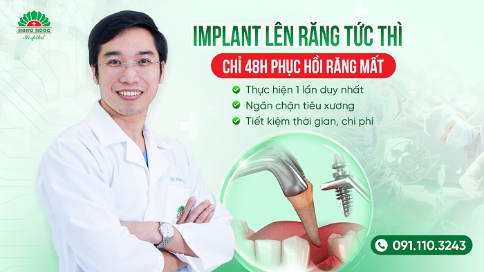 Cay ghep Implant len rang tuc thi giup tiet kiem thoi gian va chi phi toi da  cho benh nhan mat rang. Anh: RHM Hong Ngoc 