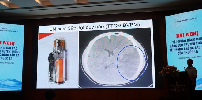 Thuốc lá điện tử làm gia tăng người nghiện thuốc lá