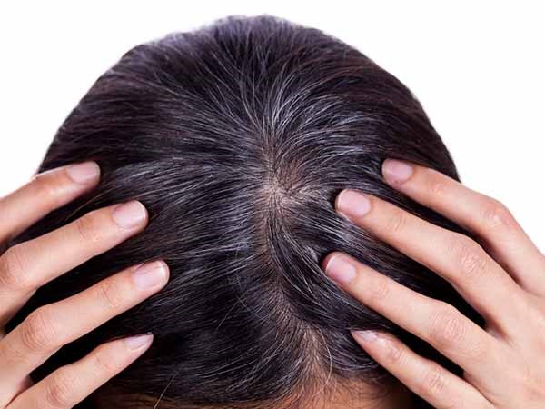 What is the difference between gray hair and gray hair? Does plucking hair affect the scalp? Photo: Laodong