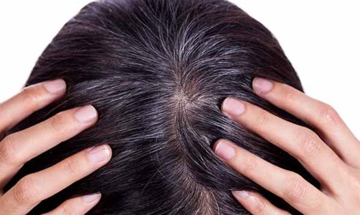Tóc bạc khác gì tóc sâu, nhổ tóc có gây ảnh hưởng da đầu? Ảnh: Laodong