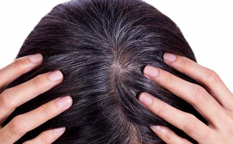What is the difference between gray hair and gray hair? Does plucking hair affect the scalp? Photo: Laodong