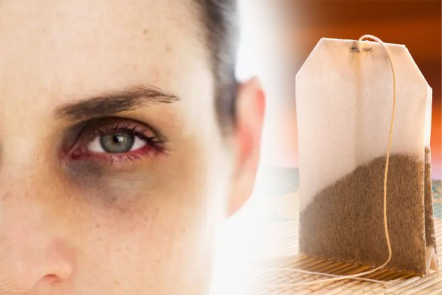 8 steps to effectively reduce eye bags and dark circles with tea bags. Graphics: Tuan Anh.