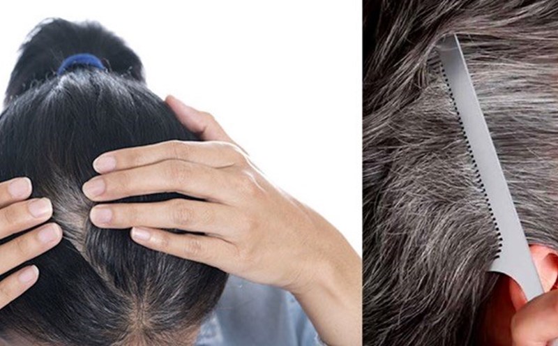 To minimize hair loss in the fall, nutrition plays an important role. Photo collage: Nguyen Ly.