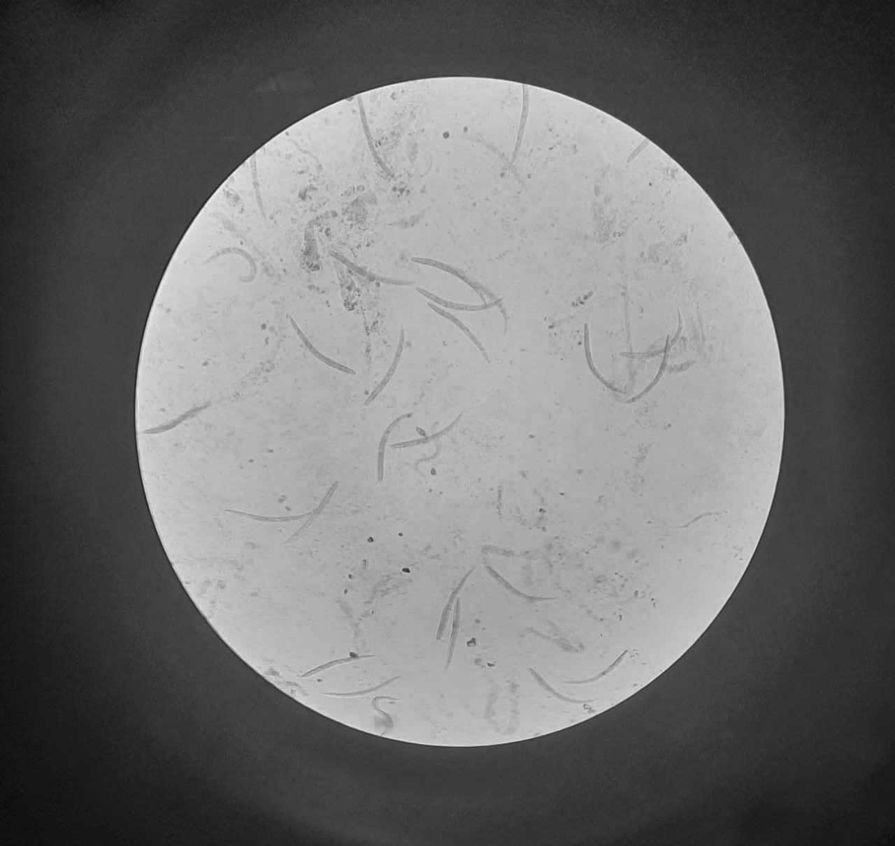 Image of roundworms in a patient's body. Photo: BVCC