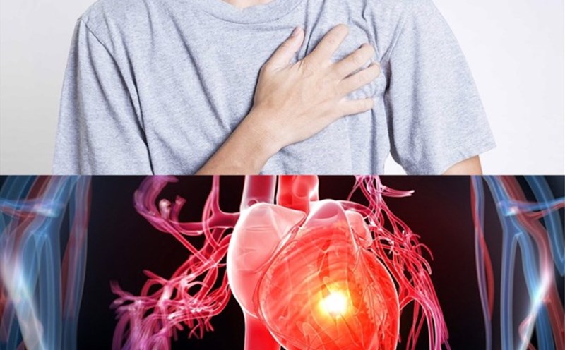 Chest pain can warn of your heart condition. Graphics: Huong Giang