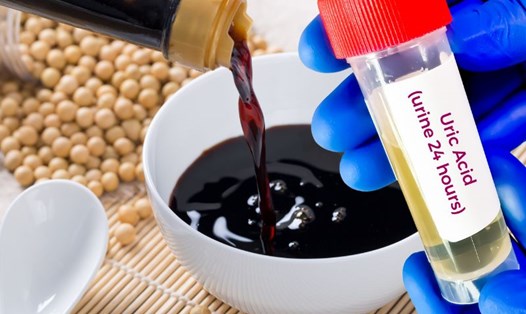 Người có axit uric cao nên ăn nước tương với lượng vừa phải. Đồ họa: Hạ Mây