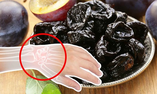 Mận khô giàu dinh dưỡng tốt cho xương và ngăn loãng xương. Đồ họa: Thanh Thanh