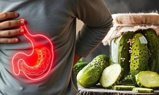 Nước dưa chua có thể làm giảm chứng trào ngược axit. Đồ hoạ: Thiện Nhân