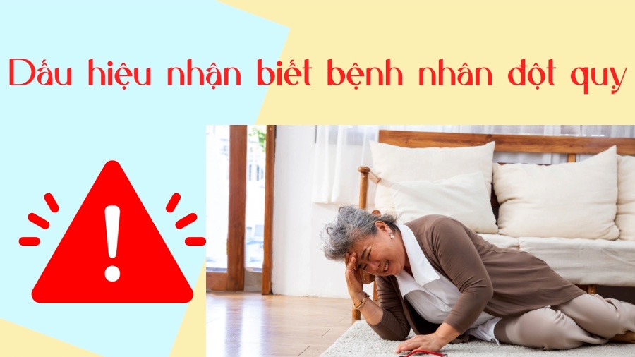 Signs of stroke patients. Graphics: Phuong Anh