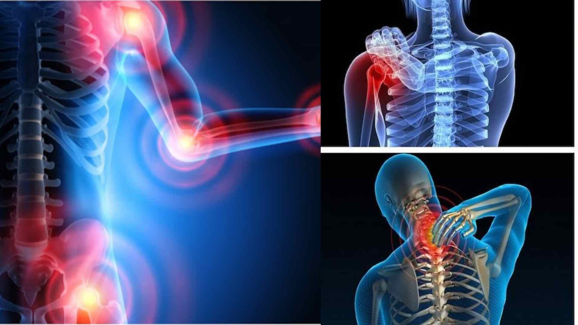 Revealing the "gold" of diet for people with arthritis. Graphics: Cao Thom