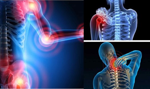 Bật mí "vàng" của chế độ ăn uống cho người bị viêm khớp. Đồ họa: Cao Thơm