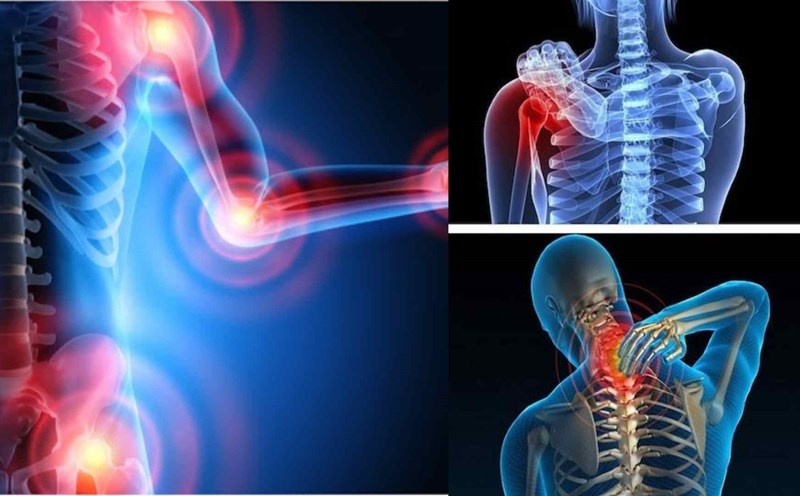 Revealing the "gold" of diet for people with arthritis. Graphics: Cao Thom