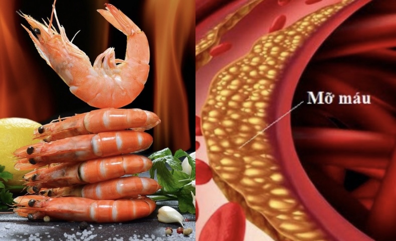 Seafood is not for people with fatty blood. Graphics: Huong Giang