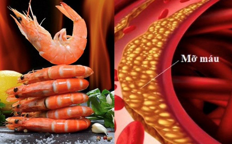 Seafood is not for people with fatty blood. Graphics: Huong Giang