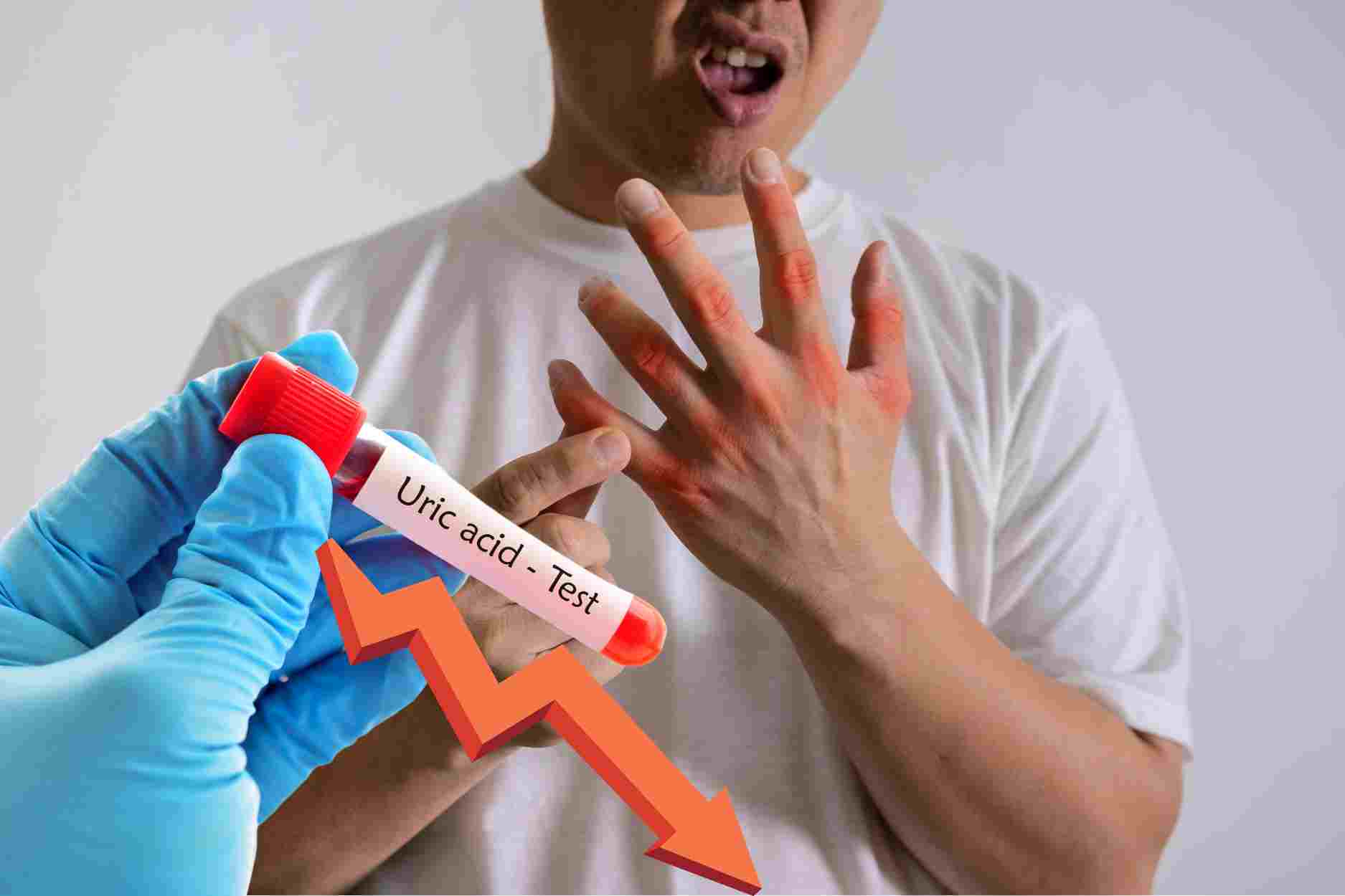 2 cách giúp đào thải axit uric nhanh chóng trong 10 ngày