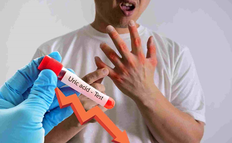 2 ways to help eliminate uric acid quickly in 10 days