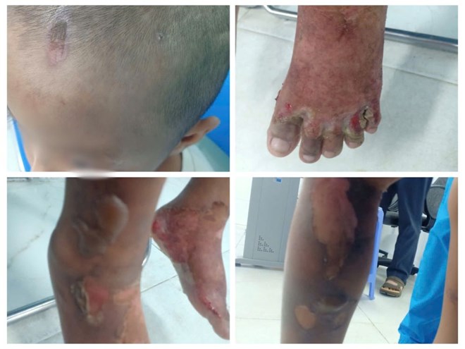 Those who abused 6-year-old children must be severely punished. Photo: Minh Anh