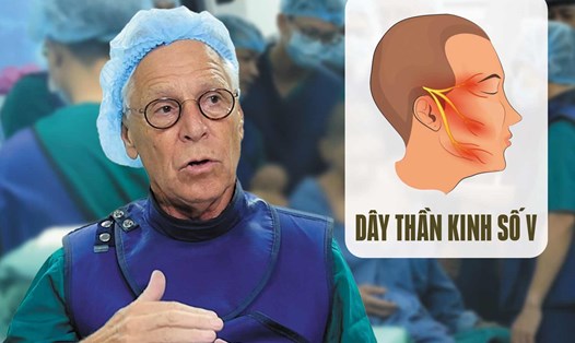 Đau dây thần kinh số V