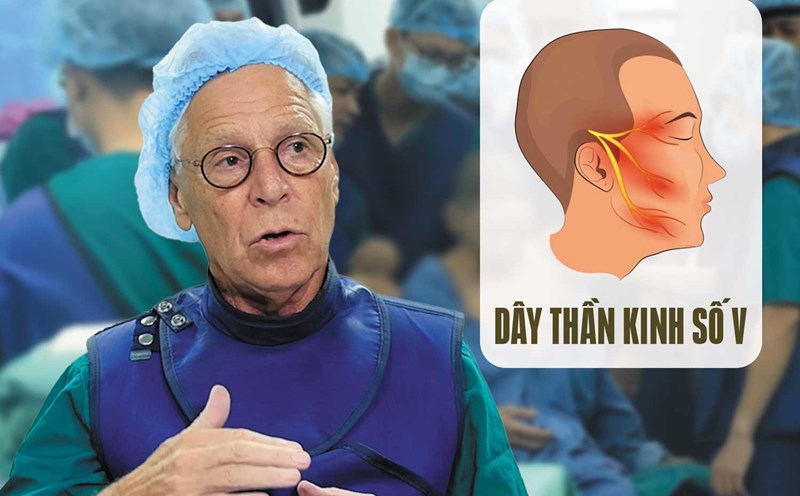 Trigeminal neuralgia
