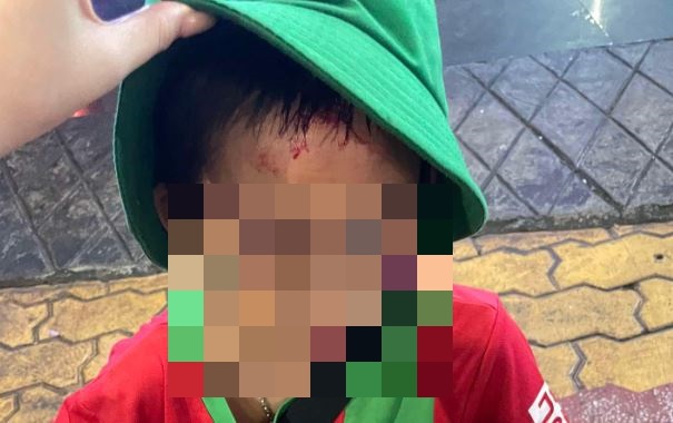 Authorities are investigating the injuries on the street vendor child. Photo: Bao Trung