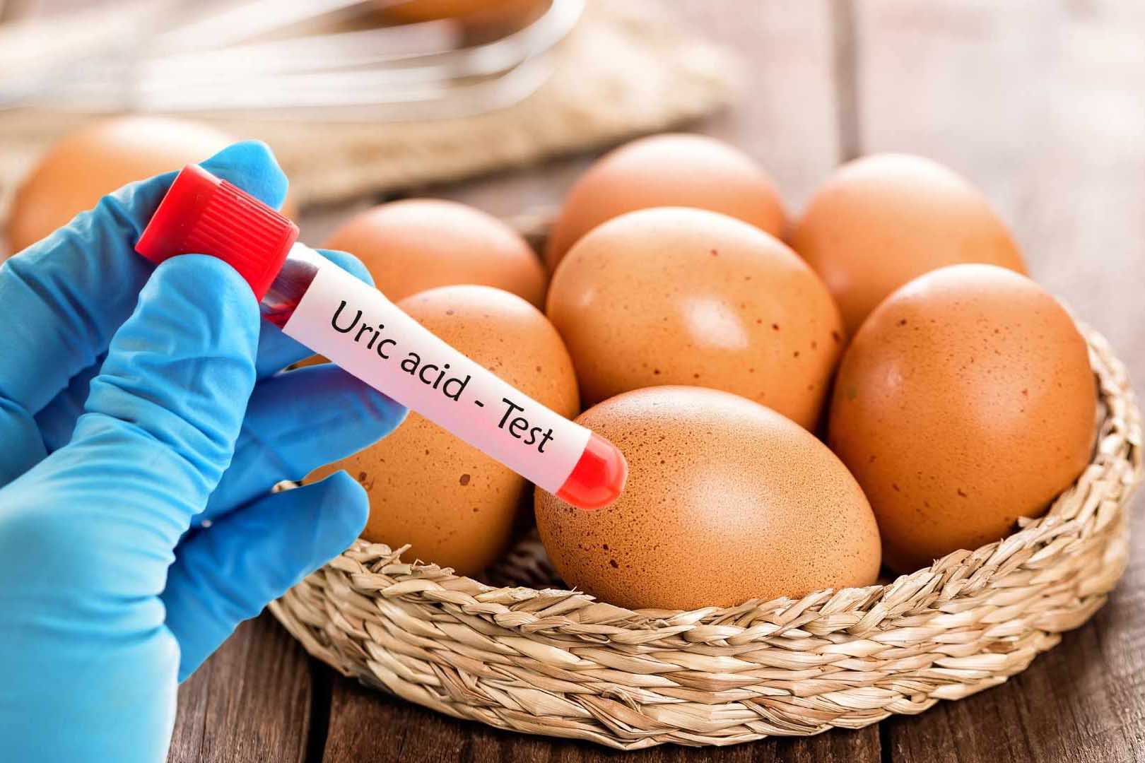 Người axit uric cao có nên ăn trứng không?