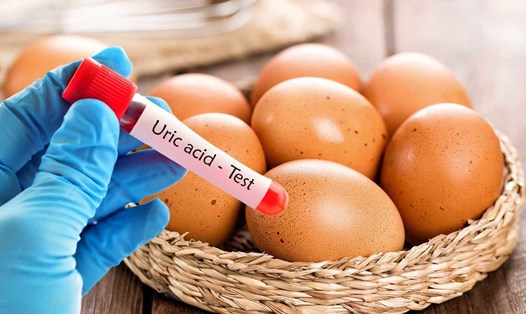 Người axit uric cao có nên ăn trứng không?