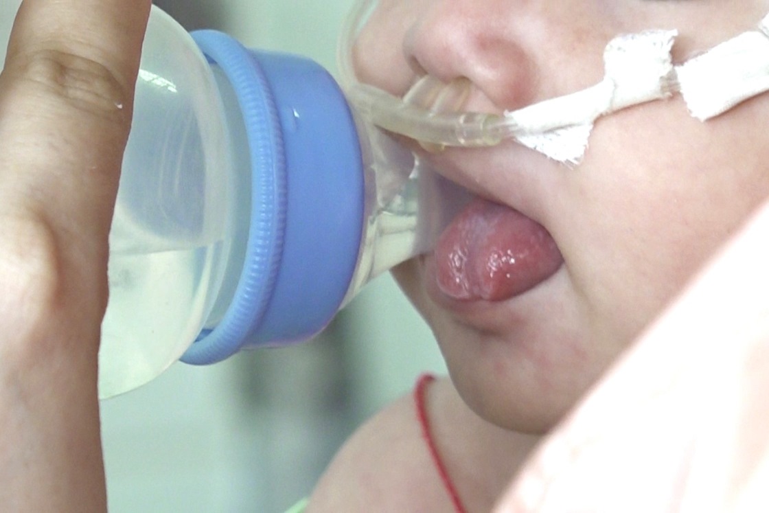 Nhiều ca sởi biến chứng nặng tại Bệnh viện Nhi đồng Cần Thơ. Ảnh: Tạ Quang