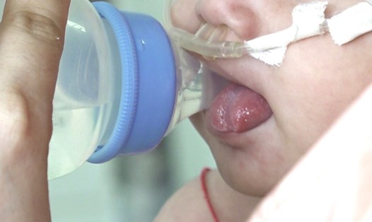 Nhiều ca sởi biến chứng nặng tại Bệnh viện Nhi đồng Cần Thơ. Ảnh: Tạ Quang