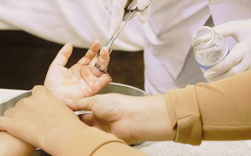 A child with a severed finger is given emergency treatment by a doctor. Photo: MINH TAM