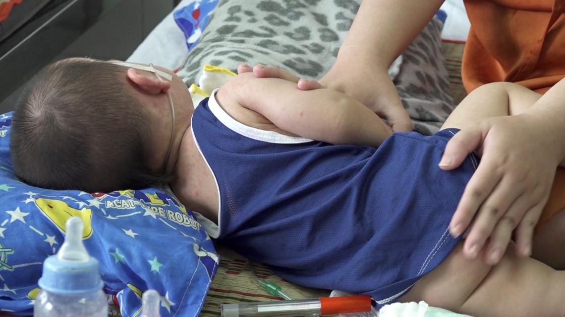 Bệnh sởi ở TP Cần Thơ. Ảnh: Tạ Quang