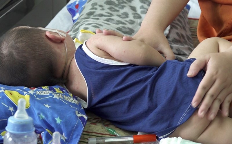 Measles in Can Tho City. Photo: Ta Quang