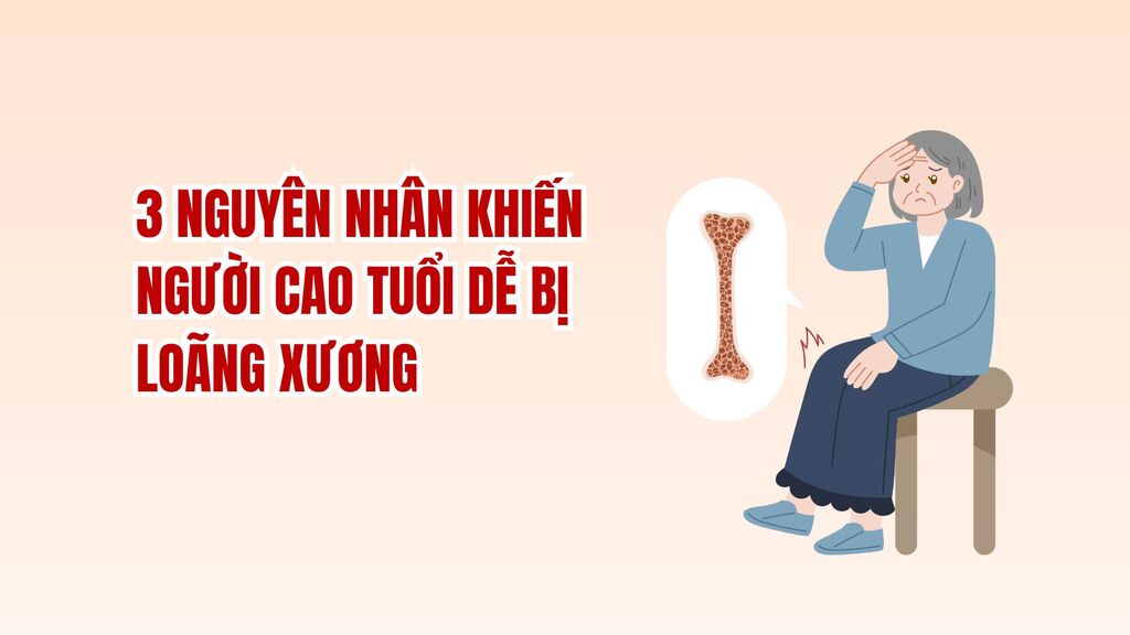 3 reasons why the elderly are susceptible to osteoporosis